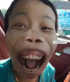 因长相奇特,被评为最丑网红竟是富二代坐拥豪车美女羡煞旁人